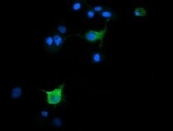 SLA2 Mouse anti-Human, Clone: OTI3H9, lyophilized, TrueMAB 100 &mu;g; Unconjugated:Antibodies,