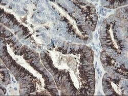 SLA2 Monoclonal Antibody (OTI3E3), TrueMAB , OriGene 30 &mu;L; Unconjugated:Antibodies,
