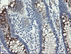 SLA2 Monoclonal Antibody (OTI3E3), TrueMAB , OriGene 30 &mu;L; Unconjugated:Antibodies,