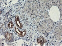 SLA2 Monoclonal Antibody (OTI1E7), TrueMAB , OriGene 100 &mu;L; Unconjugated:Antibodies,