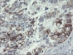 SLA2 Monoclonal Antibody (OTI3A7), TrueMAB , OriGene 30 &mu;L; Unconjugated:Antibodies,