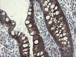 SLA2 Monoclonal Antibody (OTI3A7), TrueMAB , OriGene 30 &mu;L; Unconjugated:Antibodies,