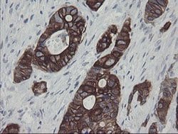 SLA2 Monoclonal Antibody (OTI3A7), TrueMAB , OriGene 30 &mu;L; Unconjugated:Antibodies,