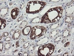 SLA2 Monoclonal Antibody (OTI3A7), TrueMAB , OriGene 30 &mu;L; Unconjugated:Antibodies,