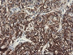 SLA2 Monoclonal Antibody (OTI3A7), TrueMAB , OriGene 30 &mu;L; Unconjugated:Antibodies,