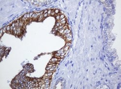 SLA2 Mouse anti-Human, Clone: OTI2B2, lyophilized, TrueMAB 100 &mu;g; Unconjugated:Antibodies,