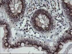 SLA2 Monoclonal Antibody (OTI1F7), TrueMAB , OriGene 30 &mu;L; Unconjugated:Anticuerpos