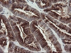 SLA2 Monoclonal Antibody (OTI4A11), TrueMAB , OriGene 100 &mu;L; Unconjugated:Antibodies,