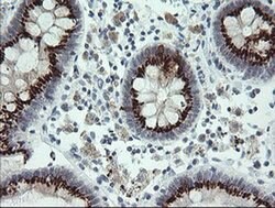 SLA2 Monoclonal Antibody (OTI4A11), TrueMAB , OriGene 100 &mu;L; Unconjugated:Antibodies,
