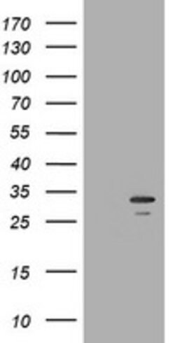 SLA2 Mouse anti-Human, Clone: OTI2B2, lyophilized, TrueMAB 100 &mu;g; Unconjugated:Antibodies,