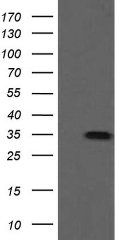 SLA2 Monoclonal Antibody (OTI1F7), TrueMAB , OriGene 30 &mu;L; Unconjugated:Anticuerpos