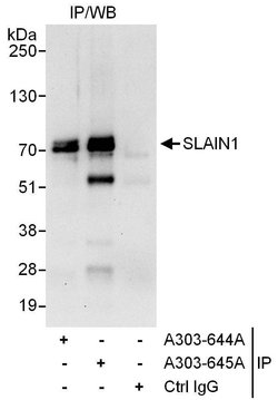 SLAIN1 Rabbit anti-Human, Polyclonal, Bethyl Laboratories 100 &mu;L; Unconjugated:Antibodies,