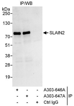 SLAIN2 Rabbit anti-Human, Polyclonal, Bethyl Laboratories 100 &mu;L | Buy Online | Bethyl Laboratories, Inc | Fisher Scientific