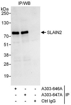 SLAIN2 Rabbit anti-Human, Polyclonal, Bethyl Laboratories 100 &mu;L; Unconjugated:Antibodies,