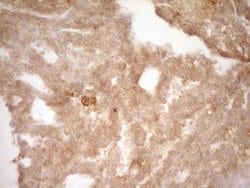 SLAMF7 Monoclonal Antibody (OTI1F1), TrueMAB , OriGene 100 &mu;L; Unconjugated:Antibodies,