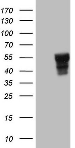 SLAMF7 Monoclonal Antibody (OTI3B3), TrueMAB , OriGene 100 &mu;L; Unconjugated:Antibodies,