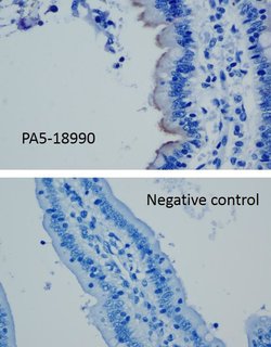 Invitrogen SLC10A2 Polyclonal Antibody 100 &mu;g; Unconjugated:Antibodies,