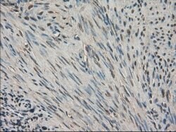 SLC18A2 Mouse anti-Human, Clone: OTI10C11, liquid, TrueMAB 100 &mu;L; Unconjugated:Antibodies,