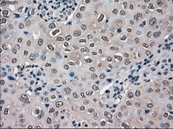 SLC18A2 Mouse anti-Human, Clone: OTI10C11, liquid, TrueMAB 100 &mu;L; Unconjugated:Antibodies,