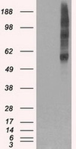 SLC18A2 Mouse anti-Human, Clone: OTI10C11, liquid, TrueMAB 100 &mu;L; Unconjugated:Antibodies,