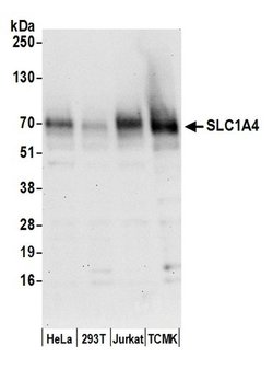 SLC1A4/ASCT1 Polyclonal Antibody, Bethyl Laboratories 20 &mu;L | Buy Online | Bethyl Laboratories, Inc | Fisher Scientific