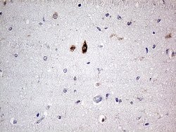 SLC22A17 Mouse anti-Human, Clone: OTI2D6, TrueMAB , Origene 30 &mu;L | Buy Online | Origene Technologies | Fisher Scientific