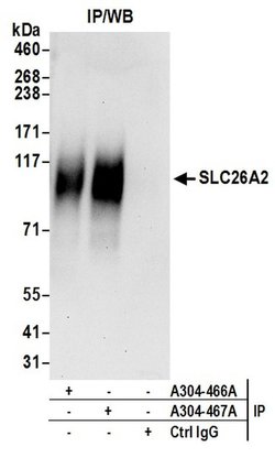 SLC26A2 Rabbit anti-Human, Polyclonal, Bethyl Laboratories 100 &mu;L; Unconjugated:Antibodies,