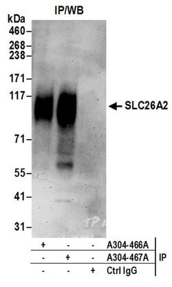 SLC26A2 Rabbit anti-Human, Polyclonal, Bethyl Laboratories 100 &mu;L; Unconjugated:Antibodies,