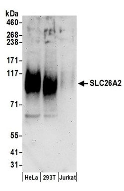 SLC26A2 Rabbit anti-Human, Polyclonal, Bethyl Laboratories 100 &mu;L; Unconjugated:Antibodies,