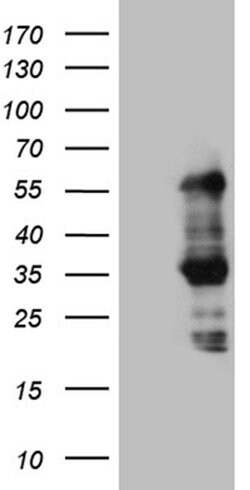 SLC2A4RG Monoclonal Antibody (OTI4B3), TrueMAB , OriGene 100 &mu;L; Unconjugated:Antibodies,