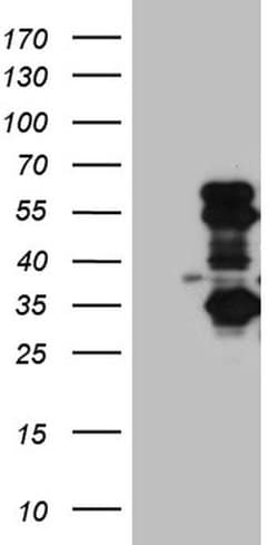 SLC2A4RG Monoclonal Antibody (OTI8A3), TrueMAB , OriGene:Antibodies:Primary