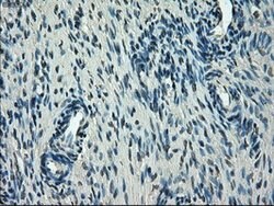 SLC2A5 Mouse anti-Human, Clone: OTI9F3, lyophilized, TrueMAB 100 &mu;g;