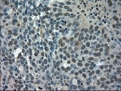 SLC2A5 Mouse anti-Human, Clone: OTI9F3, lyophilized, TrueMAB 100 &mu;g;