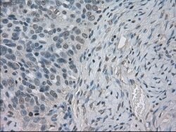SLC2A5 Mouse anti-Human, Clone: OTI11D11, lyophilized, TrueMAB 100 &mu;g;