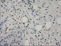 SLC2A5 Mouse anti-Human, Clone: OTI11D11, lyophilized, TrueMAB 100 &mu;g;