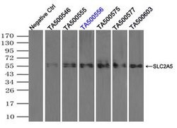 SLC2A5 Mouse anti-Human, Clone: OTI9F3, lyophilized, TrueMAB 100 &mu;g;