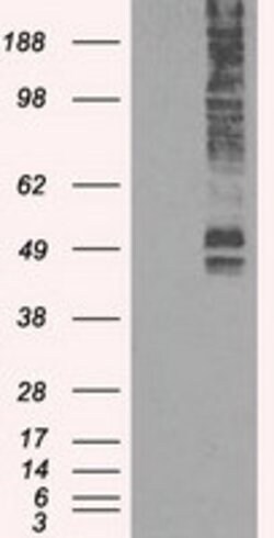 SLC2A5 Mouse anti-Human, Clone: OTI9H4, lyophilized, TrueMAB 100 &mu;g;
