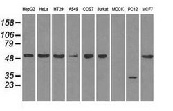 SLC2A5 Mouse anti-Human, Clone: OTI9F3, lyophilized, TrueMAB 100 &mu;g;