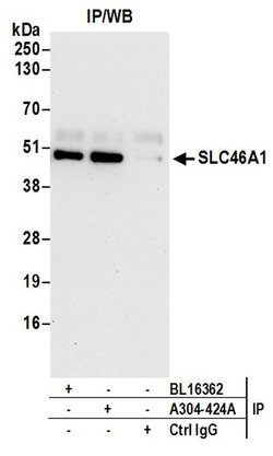 SLC46A1 Rabbit anti-Human, Polyclonal, Bethyl Laboratories 100 &mu;l; Unlabeled:Antibodies,