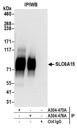 SLC6A15 Rabbit anti-Human, Polyclonal, Bethyl Laboratories 100 &mu;L; Unconjugated:Antibodies,