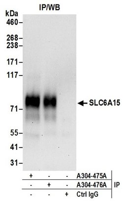 SLC6A15 Rabbit anti-Human, Polyclonal, Bethyl Laboratories 10 &mu;L | Buy Online | Bethyl Laboratories, Inc | Fisher Scientific