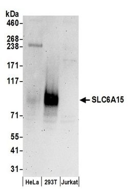 SLC6A15 Rabbit anti-Human, Polyclonal, Bethyl Laboratories 10 &mu;L | Buy Online | Bethyl Laboratories, Inc | Fisher Scientific