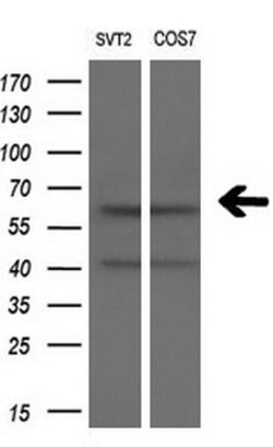 SLC7A8 Mouse anti-Human, Clone: OTI7D6, lyophilized, TrueMAB 100 &mu;g;