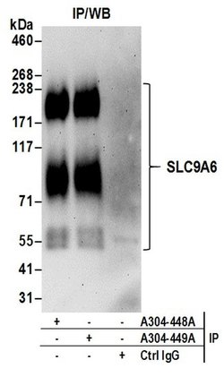 SLC9A6 Rabbit anti-Human, Polyclonal, Bethyl Laboratories 100 &mu;l; Unlabeled:Antibodies,