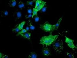 SLFNL1 Monoclonal Antibody (OTI4F7), TrueMAB , OriGene 30 &mu;L; Unconjugated:Antibodies,
