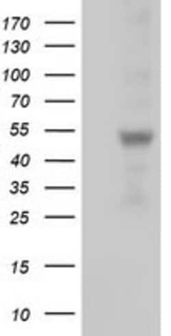 SLFNL1 Mouse anti-Human, Clone: OTI5C3, lyophilized, TrueMAB 100 &mu;g;