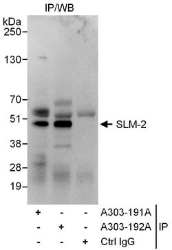 SLM-2 Rabbit anti-Human, Polyclonal, Bethyl Laboratories 10 &mu;L; Unconjugated:Antibodies,