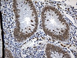 SLU7 Monoclonal Antibody (OTI6B1), TrueMAB , OriGene 100 &mu;L; Unconjugated:Antibodies,