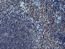 SMAD1 Monoclonal Antibody (OTI2D2), TrueMAB , OriGene:Antibodies:Primary
