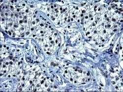 SMAD1 Monoclonal Antibody (OTI1C2), TrueMAB , OriGene 100 &mu;L; Unconjugated:Antibodies,